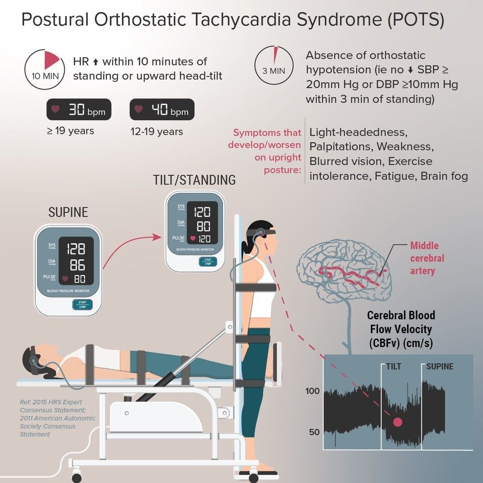 Postural Orthostatic Tachycardia Syndrome (POTS) - MEDizzy