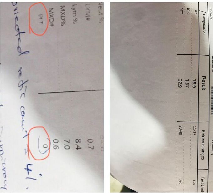 What is that ?? 😐😐.  The plt is zero.   and the PT,PTT. are normal. 😐😐🤔