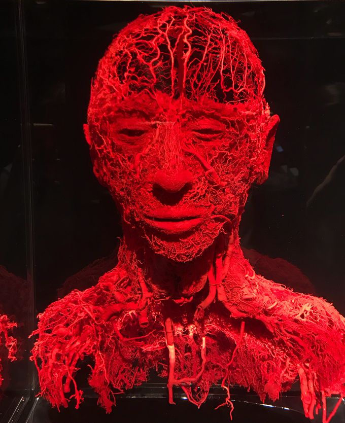 Ingenious plastination of the large blood vessels and capillaries