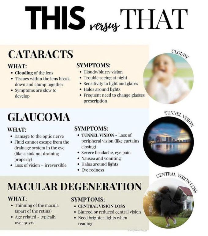 Differences between eye defects