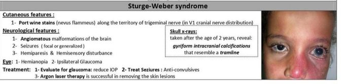 Sturge Weber Syndrome