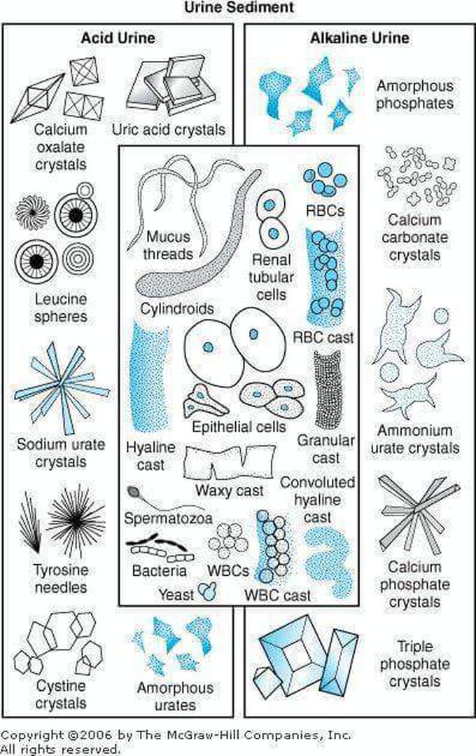 Urine sediment #_