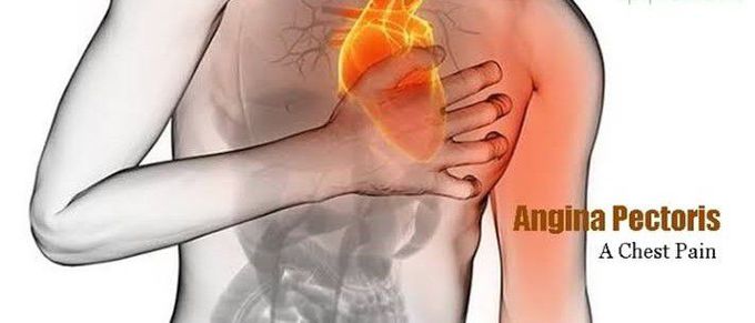 What is angina?