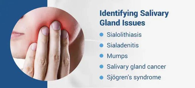 Identifying salivary gland issues
