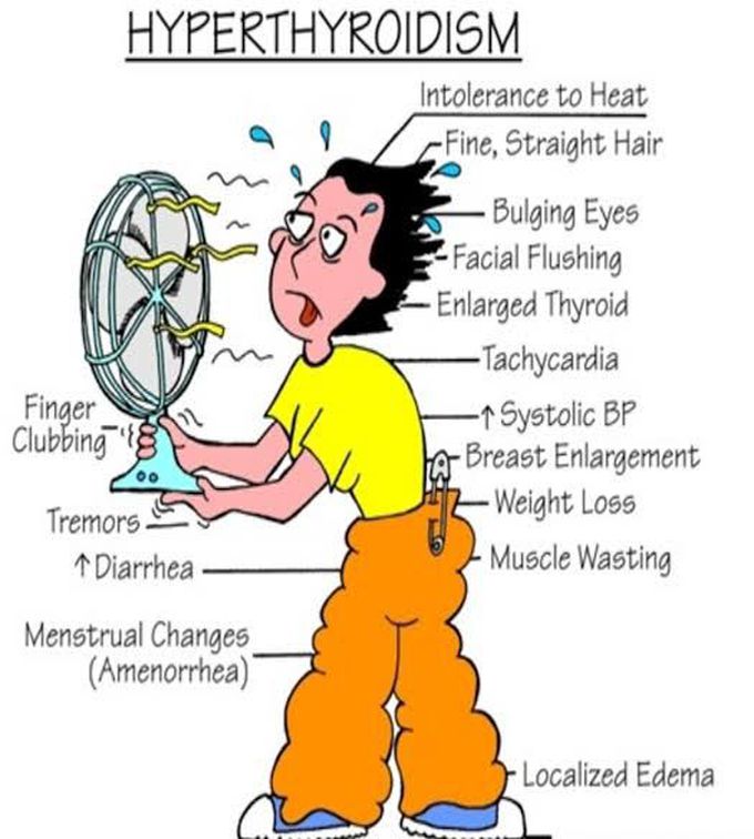 Hyperthyroidism