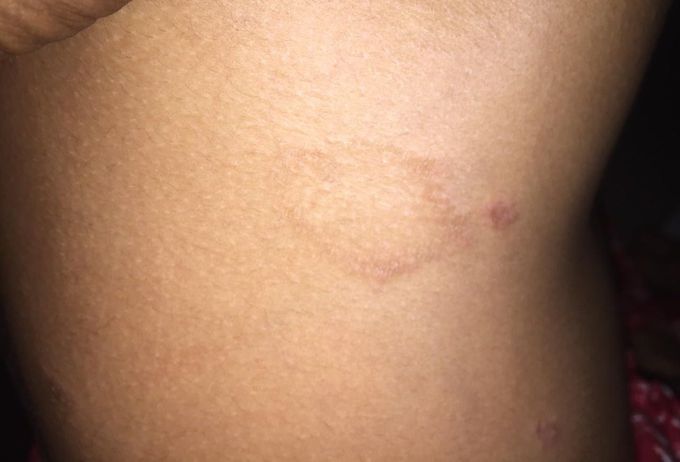 What is your diagnosis???