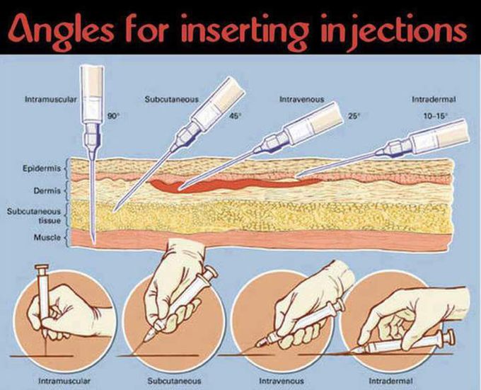 Angle for inserting injections