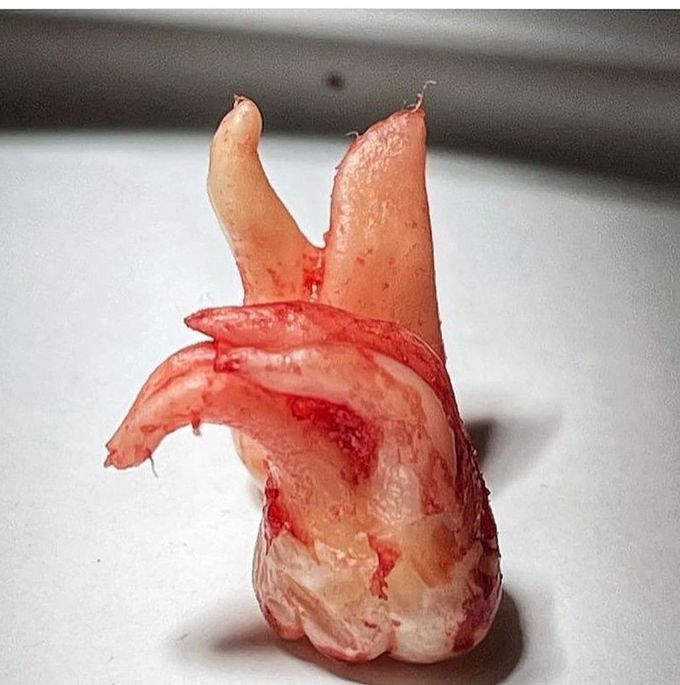 A Beautiful Extraction
