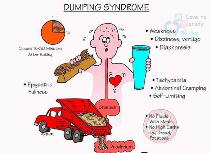 Ah ahhh dumping syndrome
