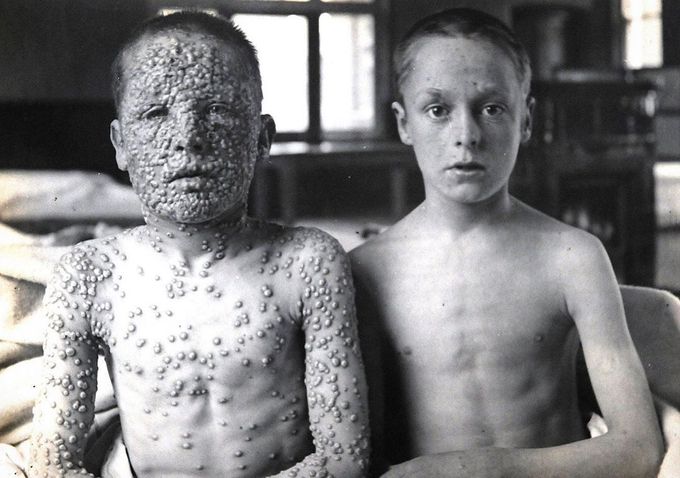 This is a picture we will no longer see today. Why? Because of vaccines. 