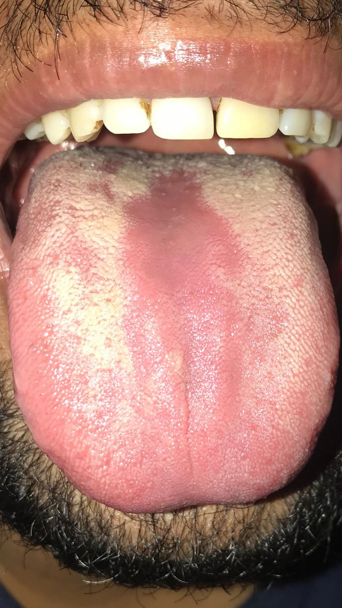 What is the diagnosis?