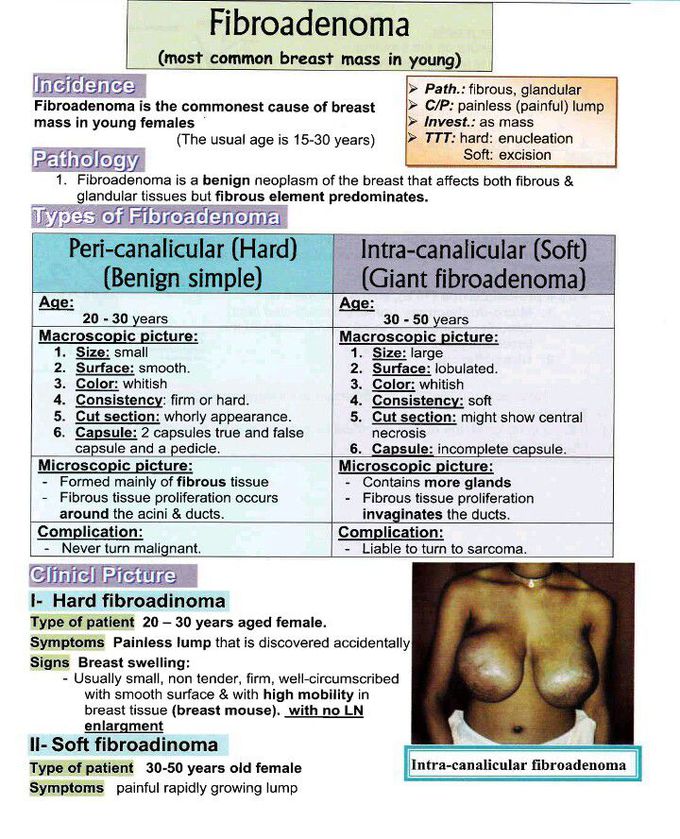 Breast mass
