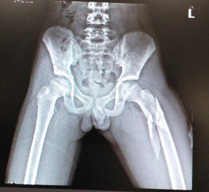 What is your diagnosis?