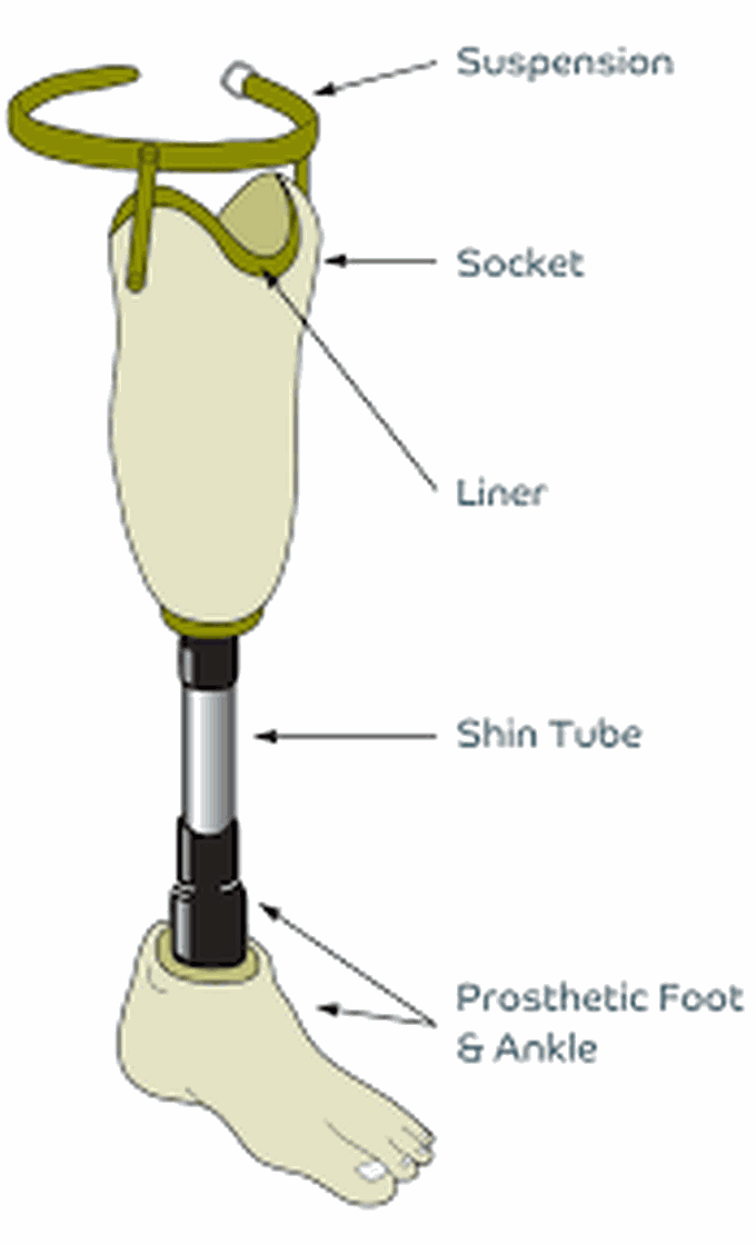 Prosthesis