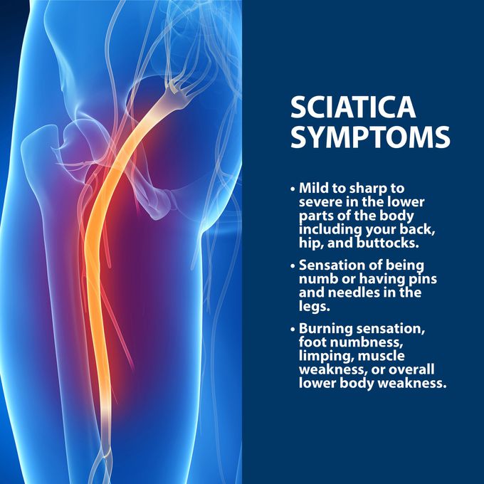 Symptoms and causes of sciatica