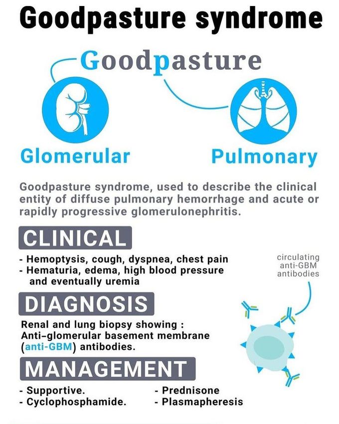 Goodpastures Syndrome