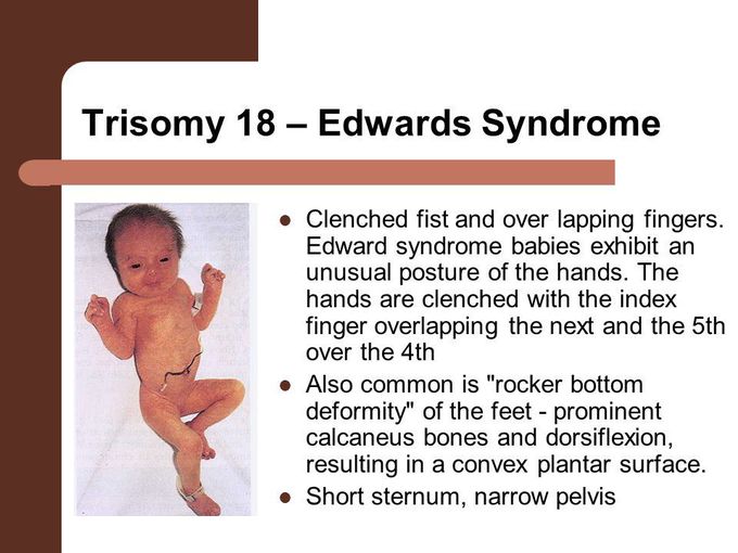 Pediatric