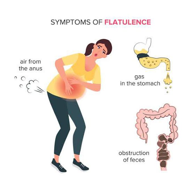 Why flatulence happens?