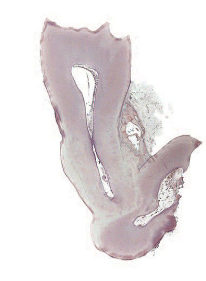 Concrescence
