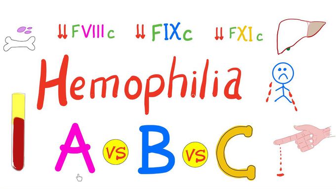Hemophilia A, Hemophilia B, and Hemophilia C | A Comparison