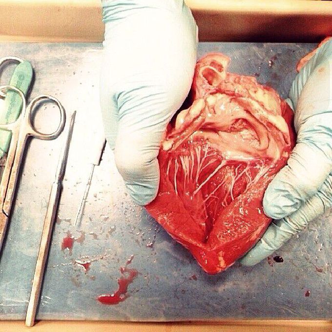 Heart dissection