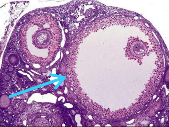 Identify the marked structure