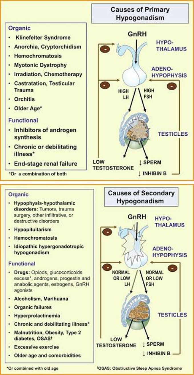 Causes of hypogonadism