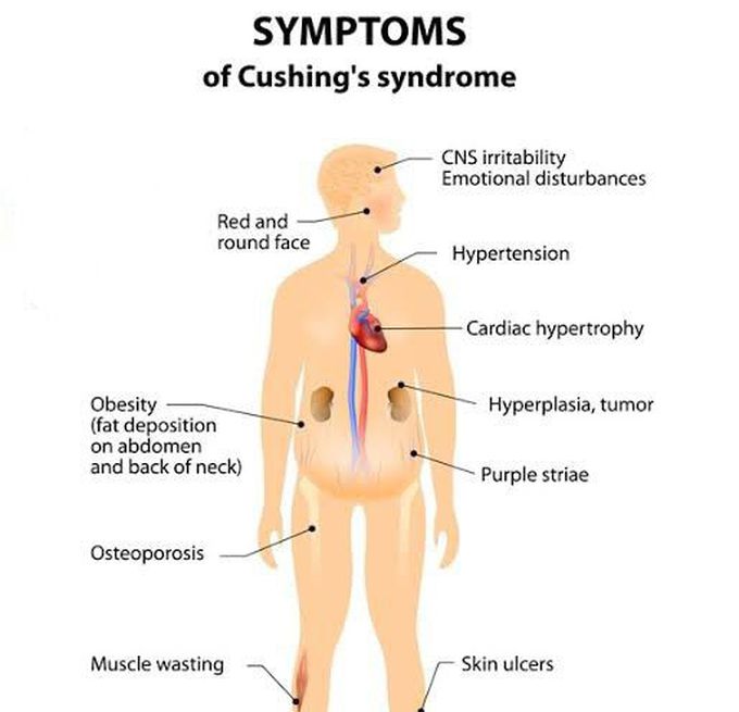 These are the symptoms of Cushing's syndrome
