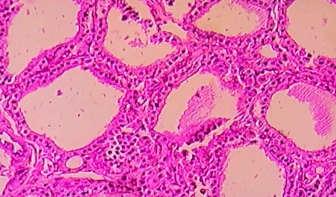 Thyroid epithelial tissue