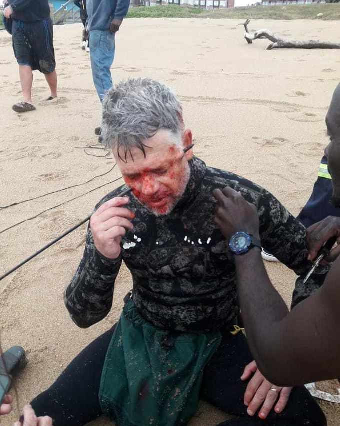 Spearfishing accident.