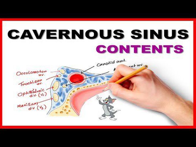 Contents of the Cavernous sinus: Easy Mnemonic