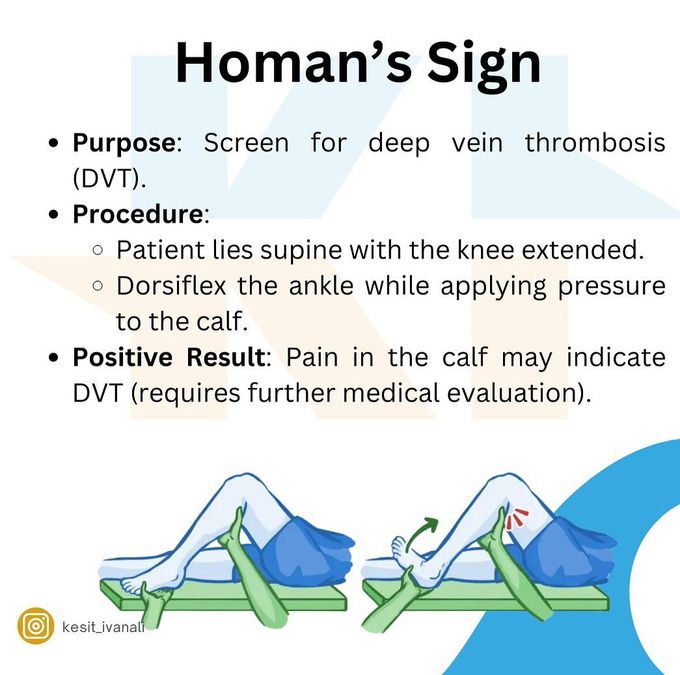 Homan's Sign