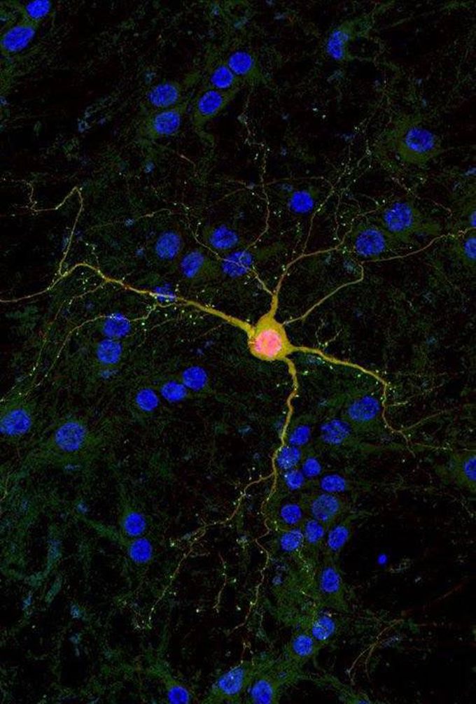 Neuron under Microscope
