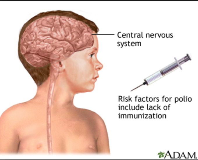 No more polio!!