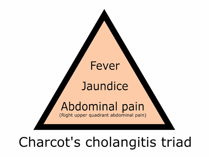 Charcots cholangitis