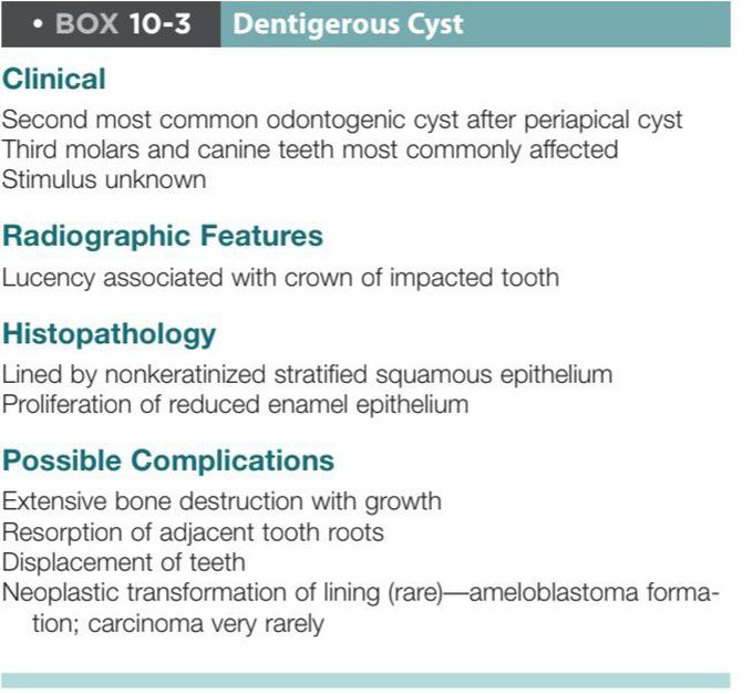 Dentigerous cyst