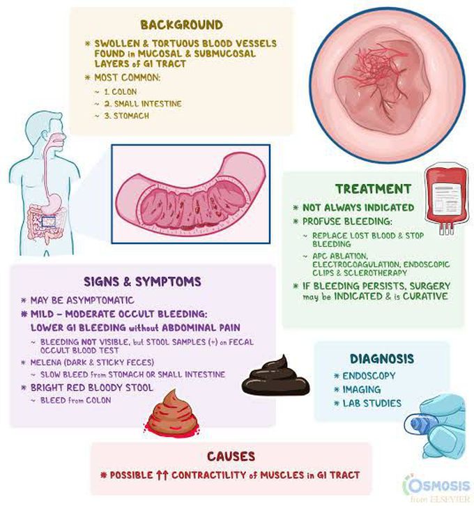 Angiodysplasia
