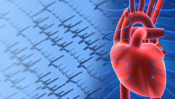 Valvular AFib Heightens Risk in TAVR