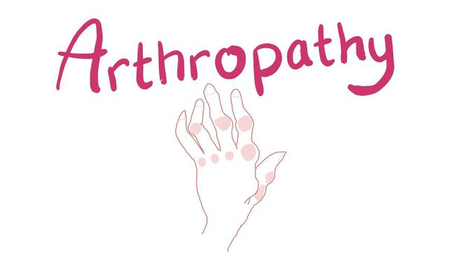Arthropathy