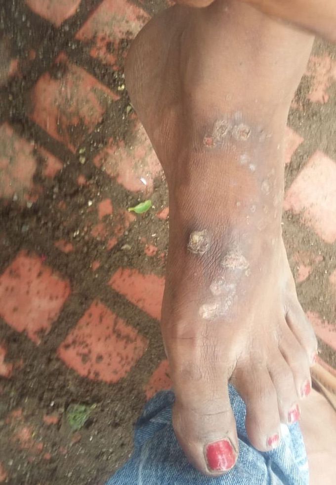 What is your diagnosis???
