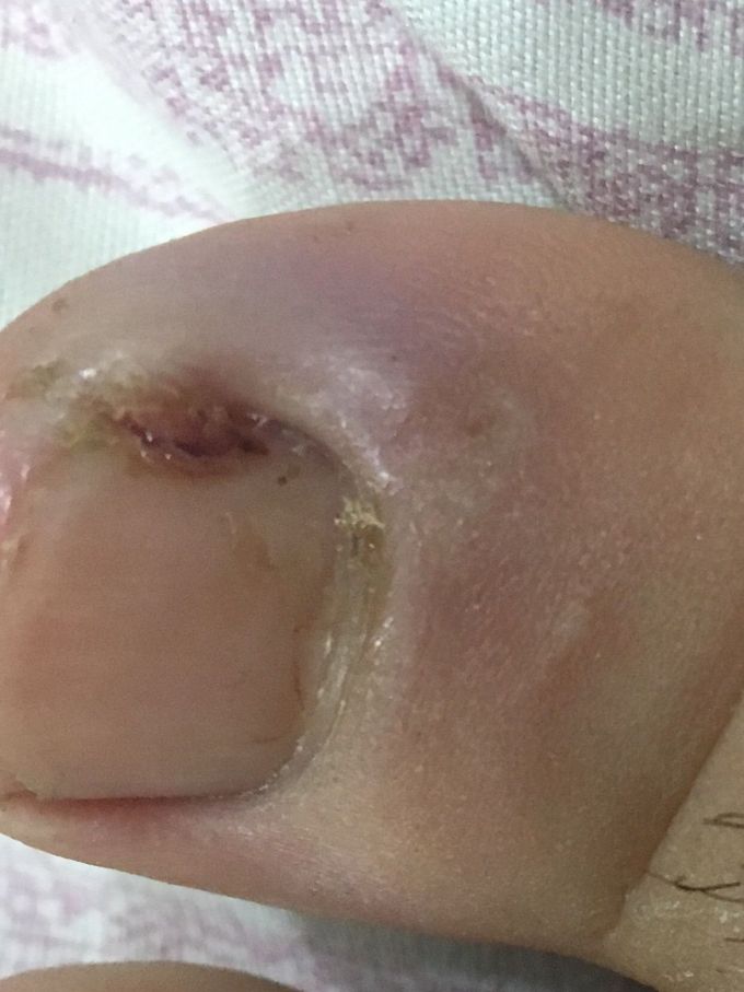 What’s the possible treatment 
