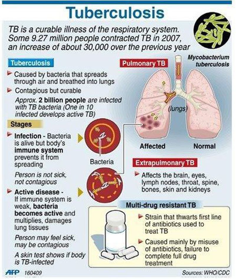 Tuberculosis - MEDizzy