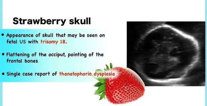 Strawberry Skull