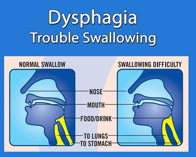 Dysphagia