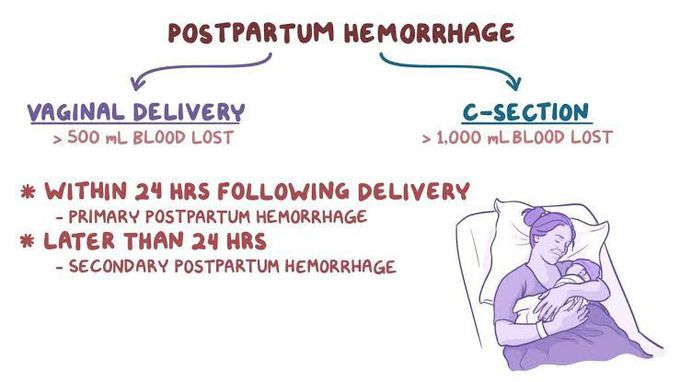 Postpartum Hemorrhages
