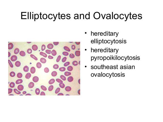 Elliptocyte and ovalocyte