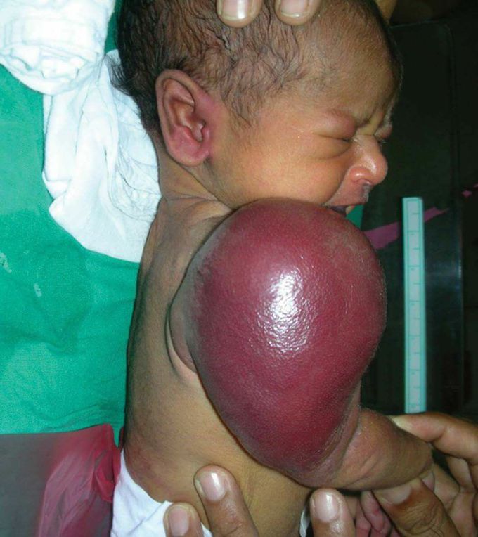 Diagnosis?
