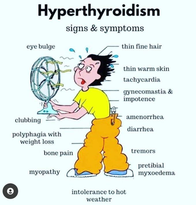 Hyperthyroidism