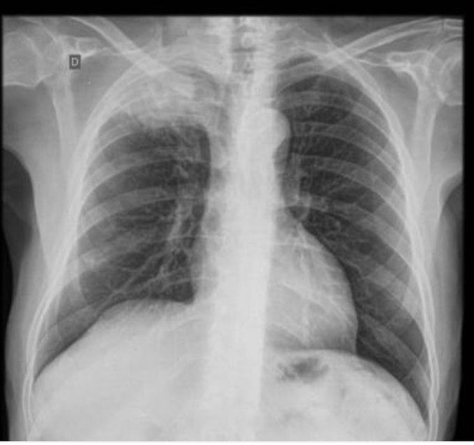 Wt will be ur diagnose....