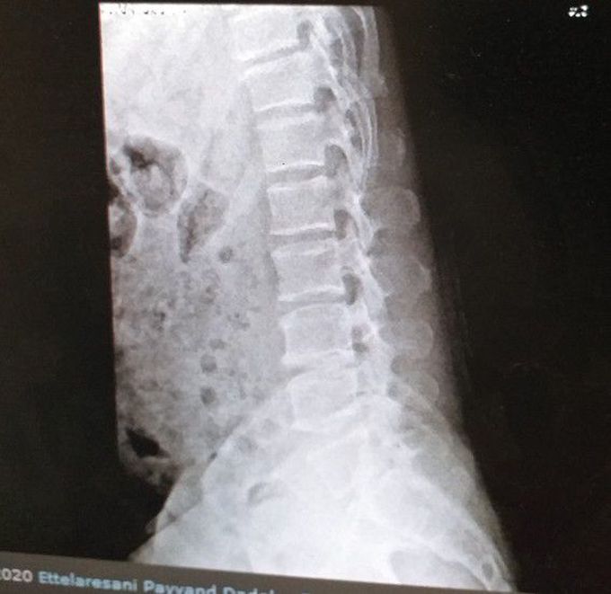What is your diagnosis?